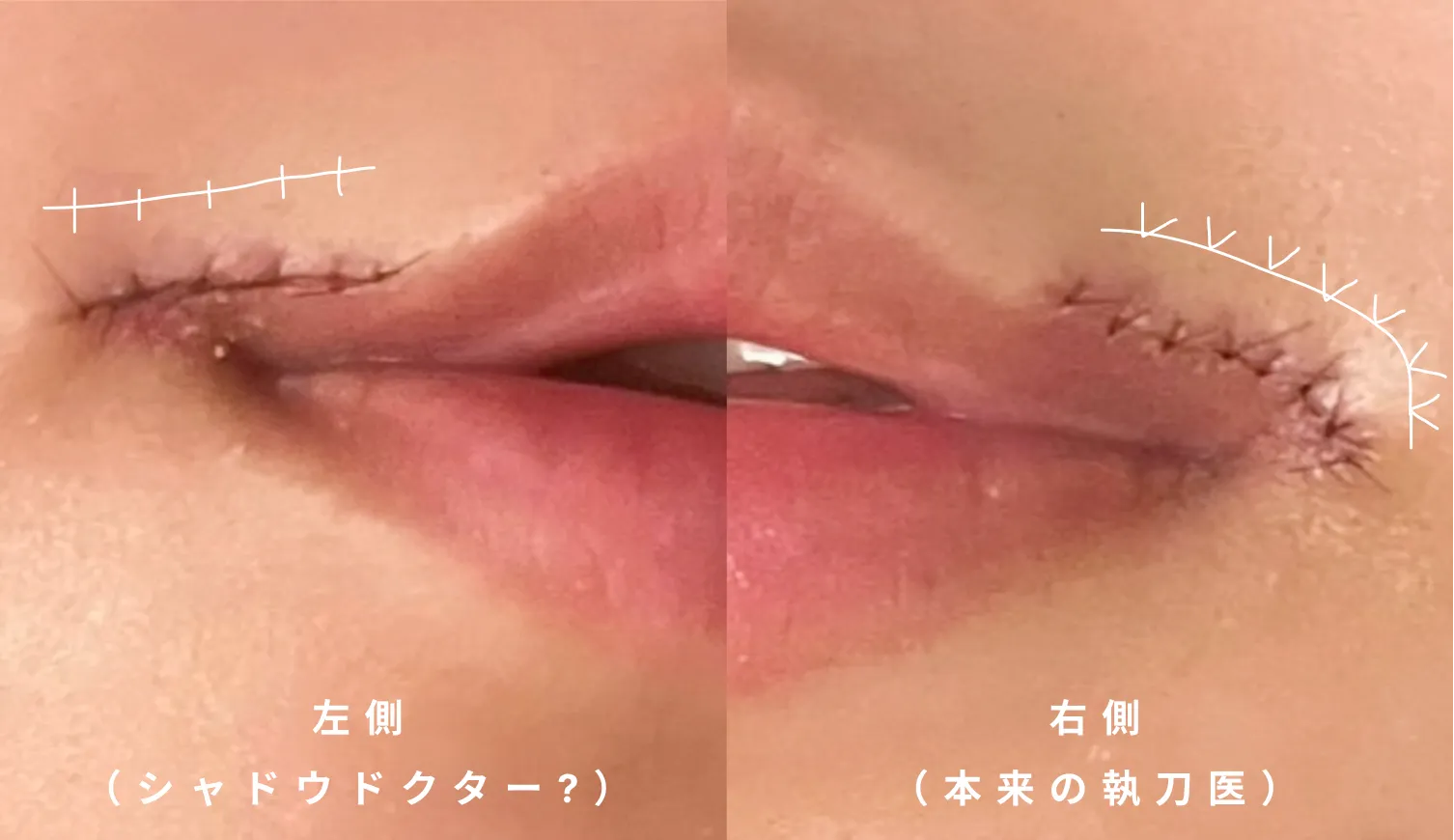 私がシャドウドクターを疑う理由